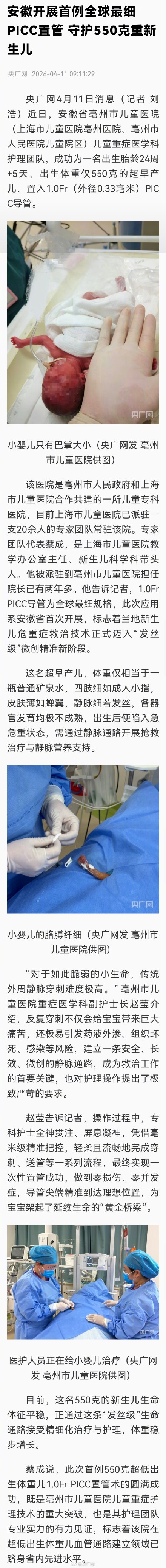 医护为550克宝宝打通“发丝级”生命通路 医护为550克宝宝打通“发丝级”生命通路