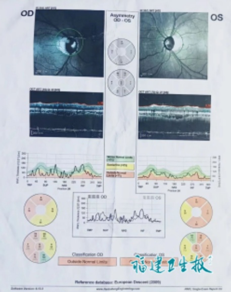 悔惨!福建21岁小伙双眼濒临失明,竟因滴眼药水的习惯 悔惨!福建21岁小伙双眼濒临失明,竟因滴眼药水的习惯