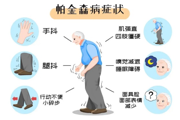 这种病，中国有500多万人中招！便秘可能是早期信号，6个动作可自查——