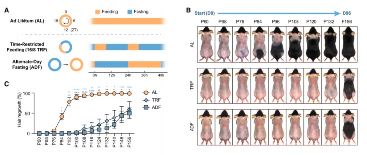 别再盲目跟风，这种饮食方式可能让你越吃越秃！