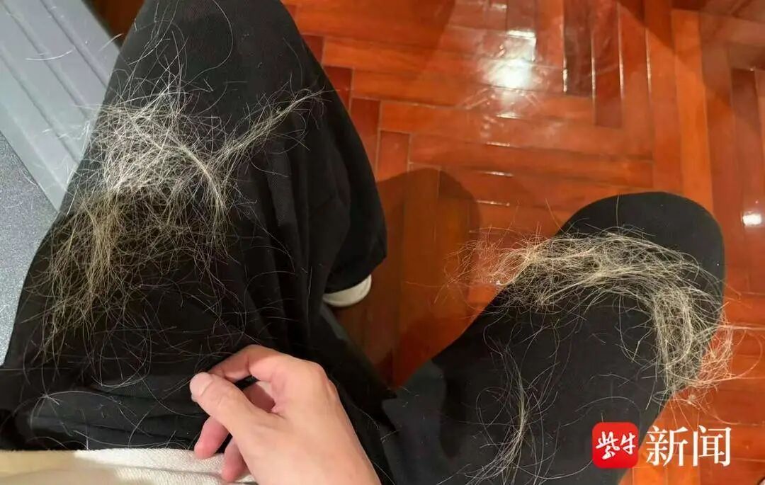 薛之谦“满头斑秃水疱”上热搜！医生建议，一年染发别超过4次