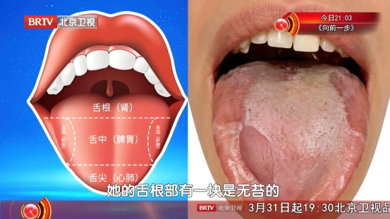 国医大师公布“散结汤”，海带加它煮，三高稳了，气顺了，结节、囊肿绕道走