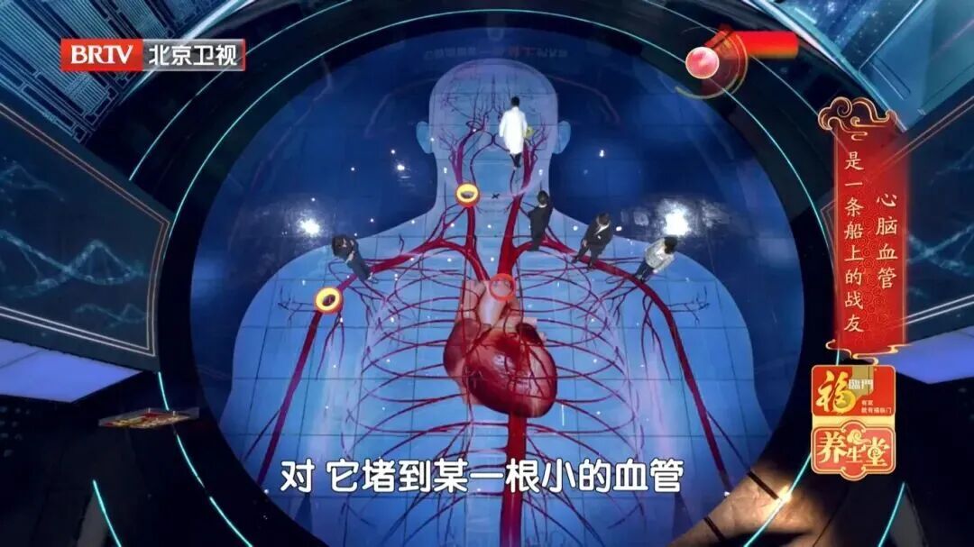 它是动脉硬化 “加速器”！伤心脏、毁大脑，这6类人更危险