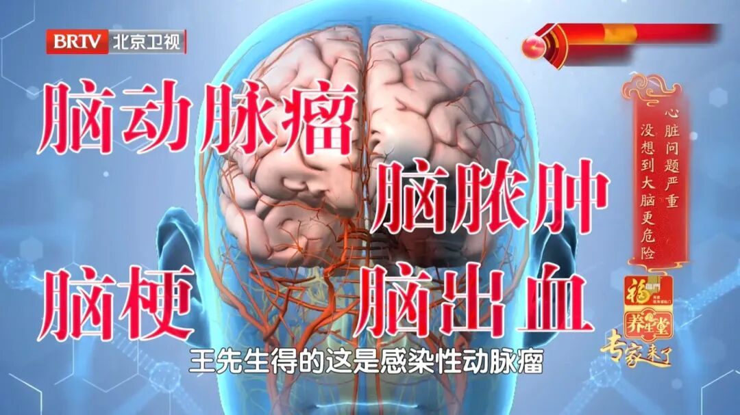 它是动脉硬化 “加速器”！伤心脏、毁大脑，这6类人更危险
