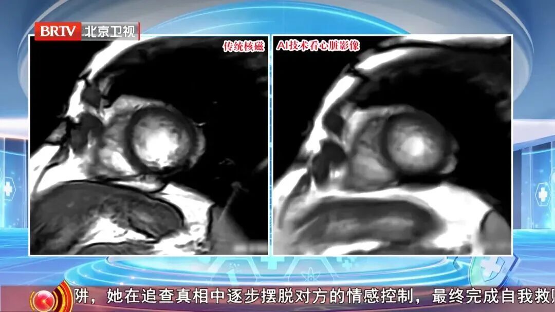 它是动脉硬化 “加速器”！伤心脏、毁大脑，这6类人更危险