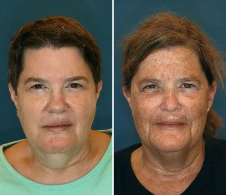 双胞胎看起来竟然差 10 岁！这个生活习惯真的让你更显老，现在改还来得及