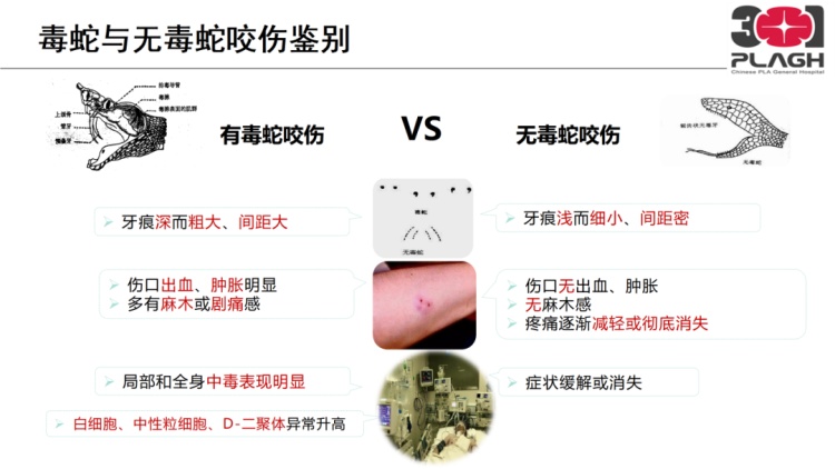 呼吸衰竭3天后转危为安，被蛇咬了怎么办？