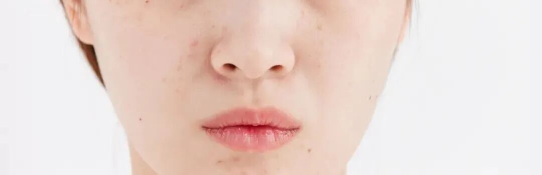 嘴唇发紫就是心脏不好吗？