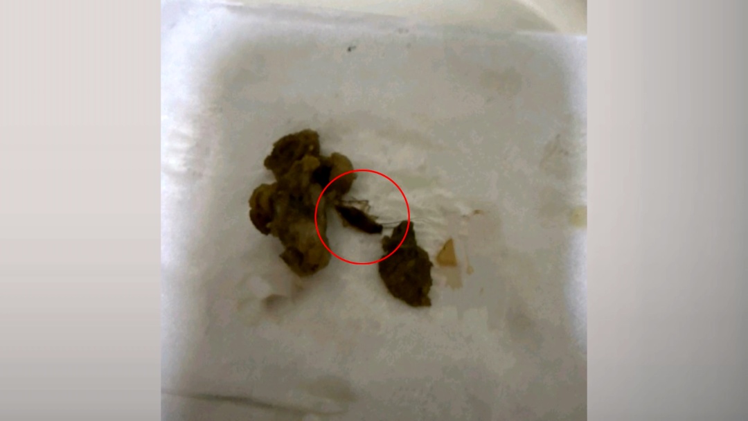 北京:3人5天内在6家餐馆“吃出蟑螂”,已被刑拘! 北京:3人5天内在6家餐馆“吃出蟑螂”,已被刑拘!