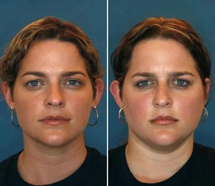 双胞胎看起来竟然差 10 岁！这个生活习惯真的让你更显老，现在改还来得及