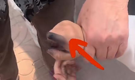 男孩一个动作，手指瞬间被“烧黑”！这些地方千万别乱碰️