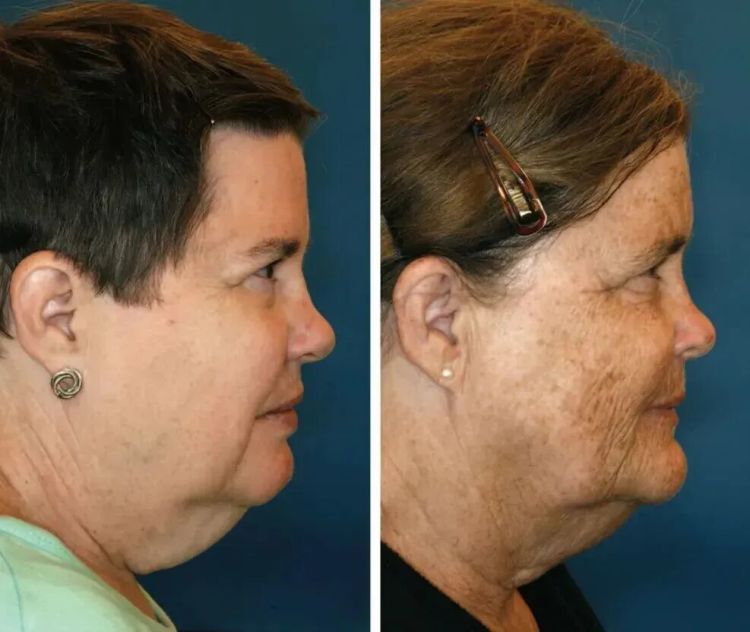 双胞胎看起来竟然差 10 岁！这个生活习惯真的让你更显老，现在改还来得及