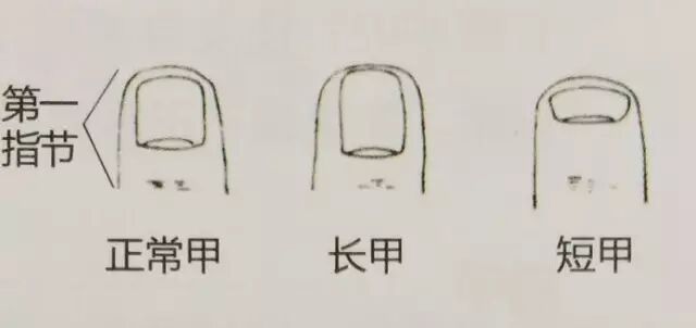 男子手指甲发紫妻子劝他去医院被怼“吃饱了没事干”,几天后老公突然胸痛被120拉走 男子手指甲发紫妻子劝他去医院被怼“吃饱了没事干”,几天后老公突然胸痛被120拉走