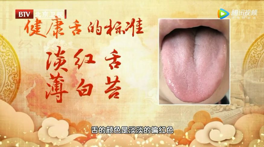 心血管不好的人，舌头会有这种变化！每天一杯羹，化瘀血、护心脏