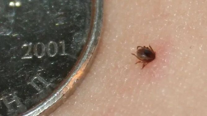 危险！身上忽然冒出这种小黑点，要尽快处理，千万别大意