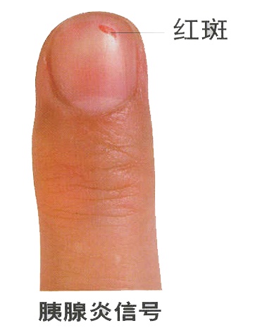 男子手指甲发紫妻子劝他去医院被怼“吃饱了没事干”,几天后老公突然胸痛被120拉走 男子手指甲发紫妻子劝他去医院被怼“吃饱了没事干”,几天后老公突然胸痛被120拉走