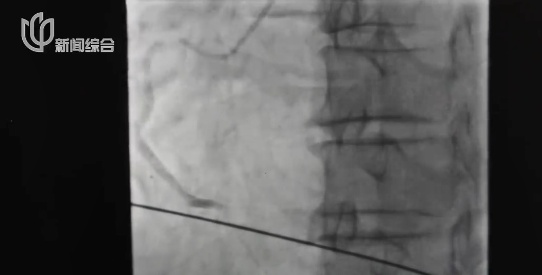 最近，很多上海人因为担心赶去医院！注意标准有变！有人直接被判定“极高危”……