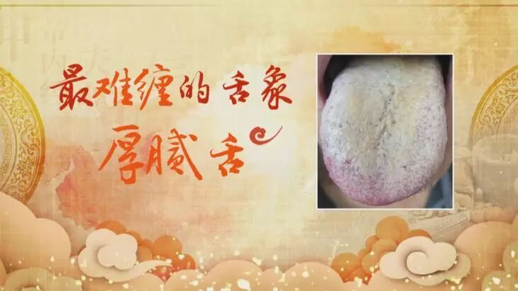 心血管不好的人，舌头会有这种变化！每天一杯羹，化瘀血、护心脏