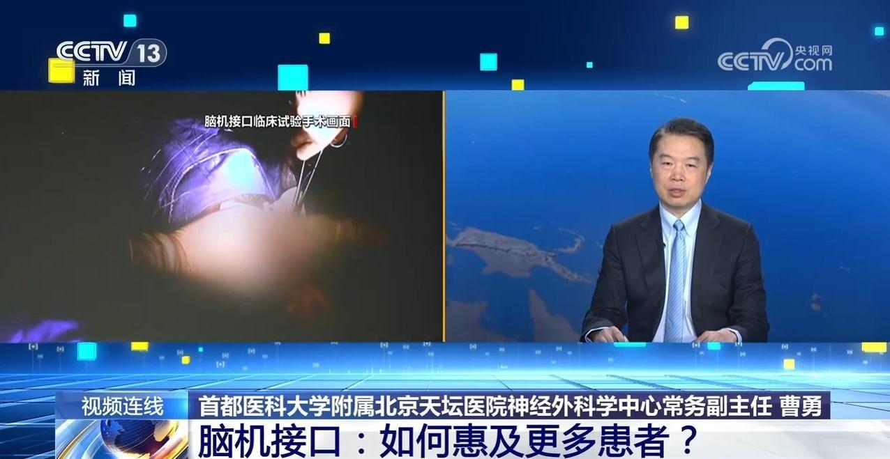 脑机接口：如何惠及更多患者？