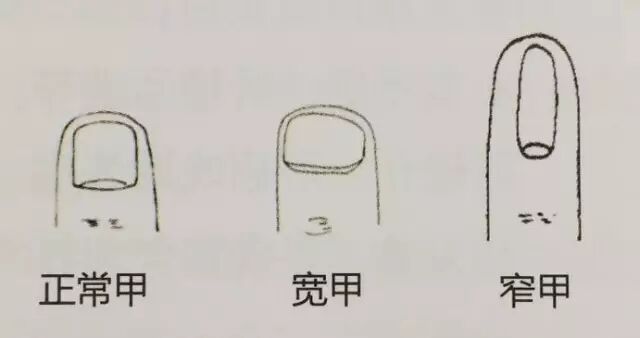 男子手指甲发紫妻子劝他去医院被怼“吃饱了没事干”,几天后老公突然胸痛被120拉走 男子手指甲发紫妻子劝他去医院被怼“吃饱了没事干”,几天后老公突然胸痛被120拉走