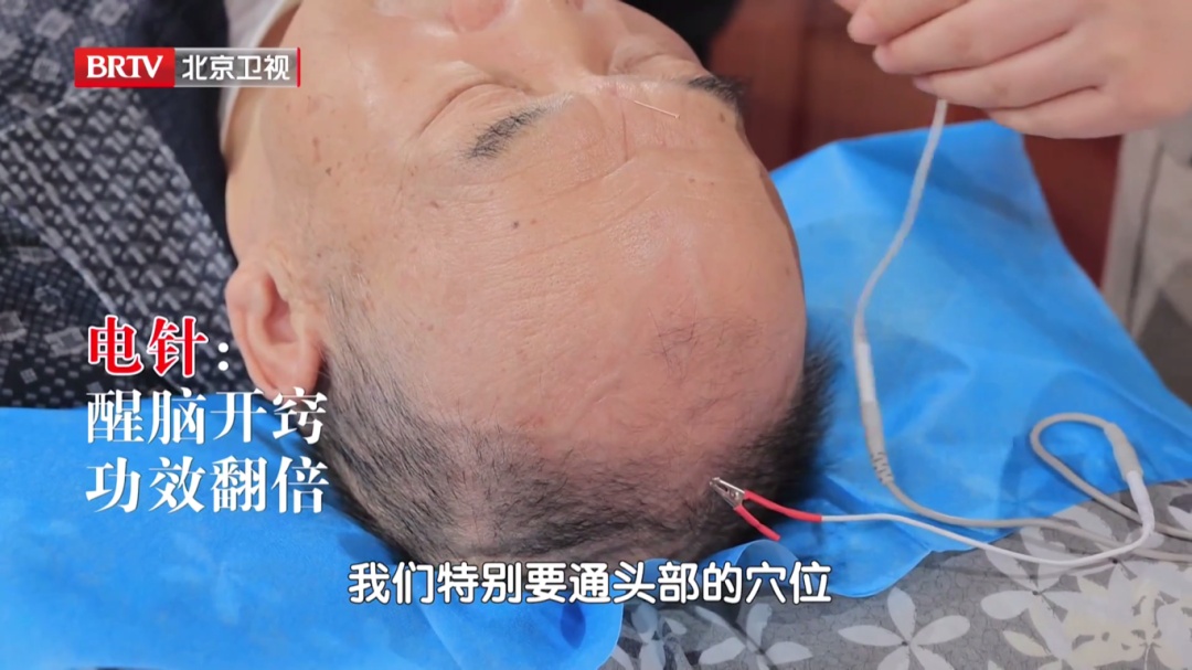 5个表现，识别老年痴呆，这套“拍手操”每天练，手脚不僵，大脑更灵光