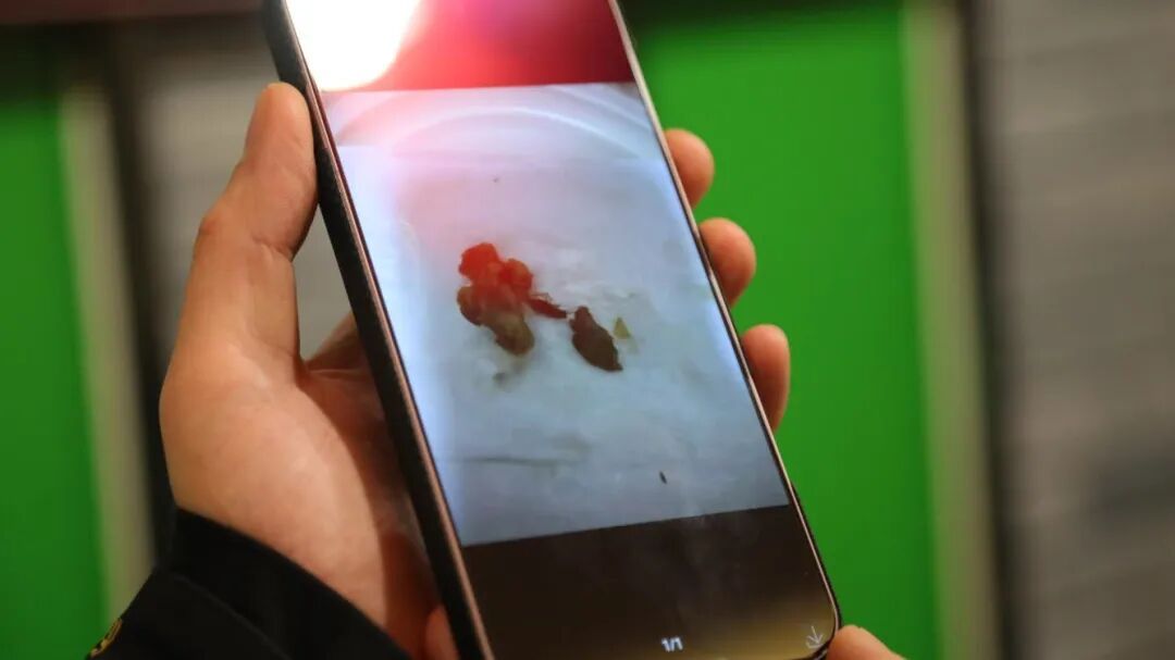 5天点6家外卖全“吃出蟑螂”？警方：刑拘