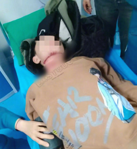 家属讲述沁阳男孩骑车遭绳索割喉细节:仍有一段气管未找到 家属讲述沁阳男孩骑车遭绳索割喉细节:仍有一段气管未找到