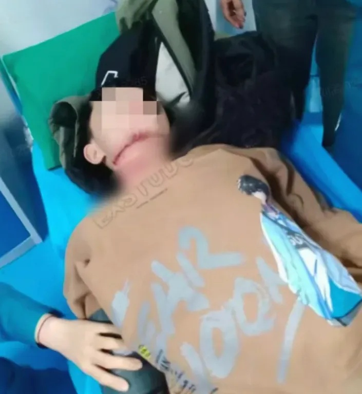 河南13岁被锁喉男孩赴京治疗后已脱离生命危险，拉绳老人已被采取刑事强制措施