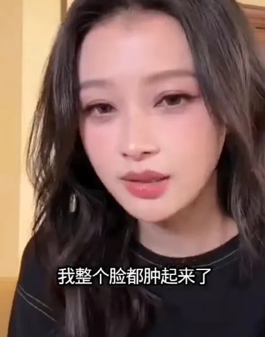 尼格买提晒出自己眼部肿胀的照片并配文：别染发