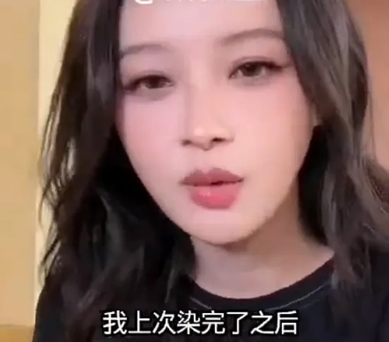 尼格买提晒出自己眼部肿胀的照片并配文：别染发