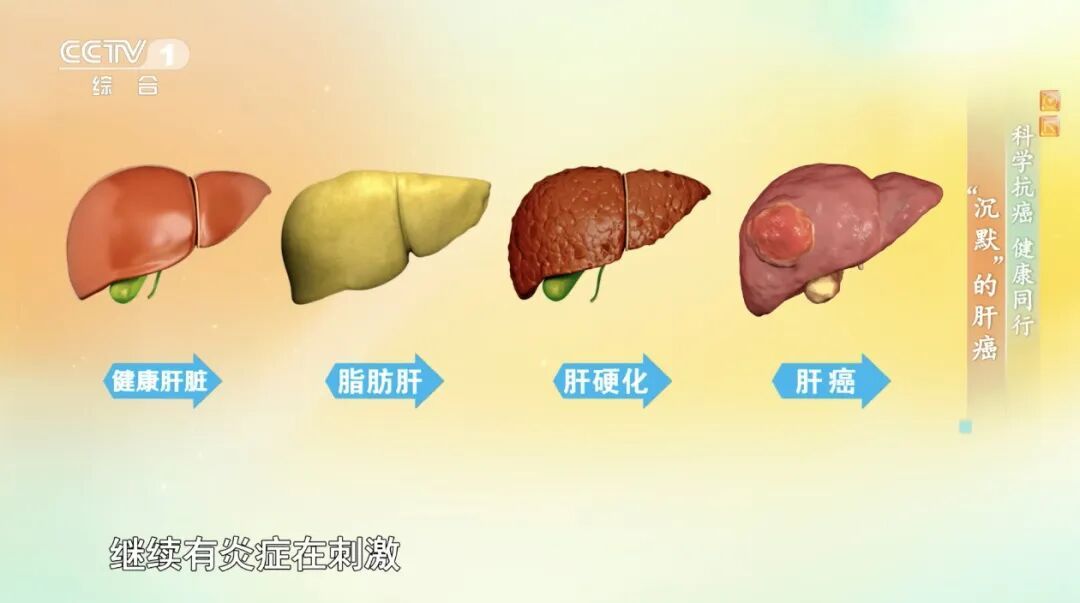 你每天入口的“它”，竟是一级致癌物，现在扔掉还来得及！