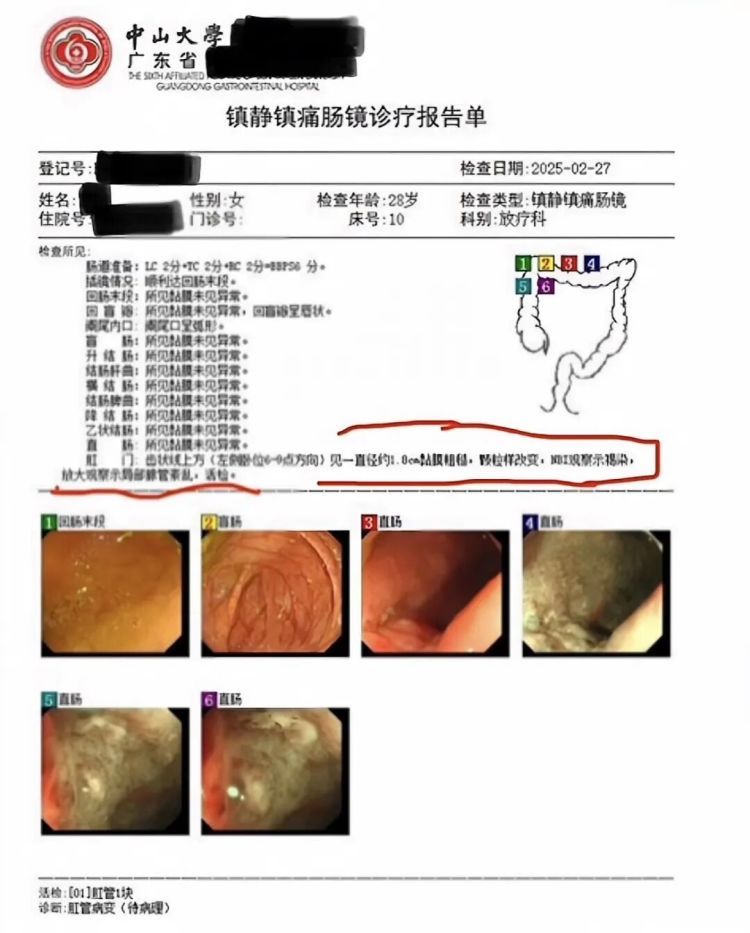 28岁女子确诊癌症中晚期！医生：排便出现这4种异常，建议及时就医！