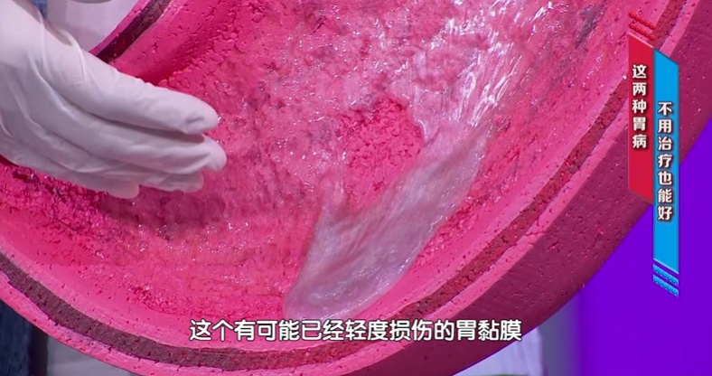 12岁确诊肠癌，元凶竟藏在日常中