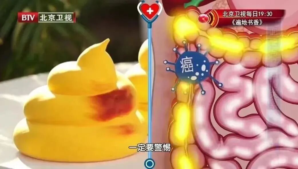 12岁确诊肠癌，元凶竟藏在日常中