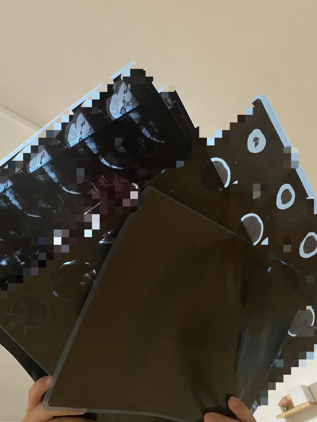 1.5元收一张旧CT片？专家提醒：别卖！