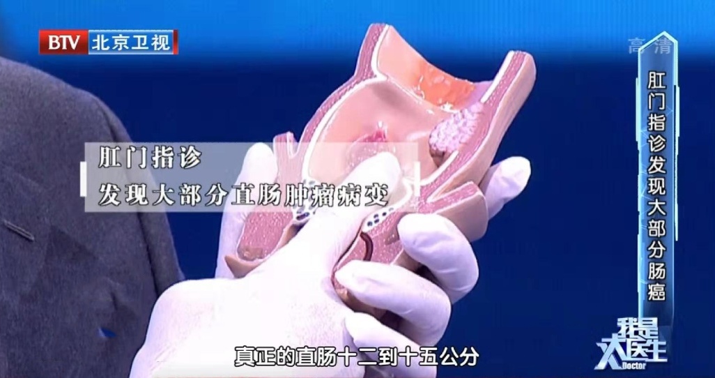 12岁确诊肠癌，元凶竟藏在日常中