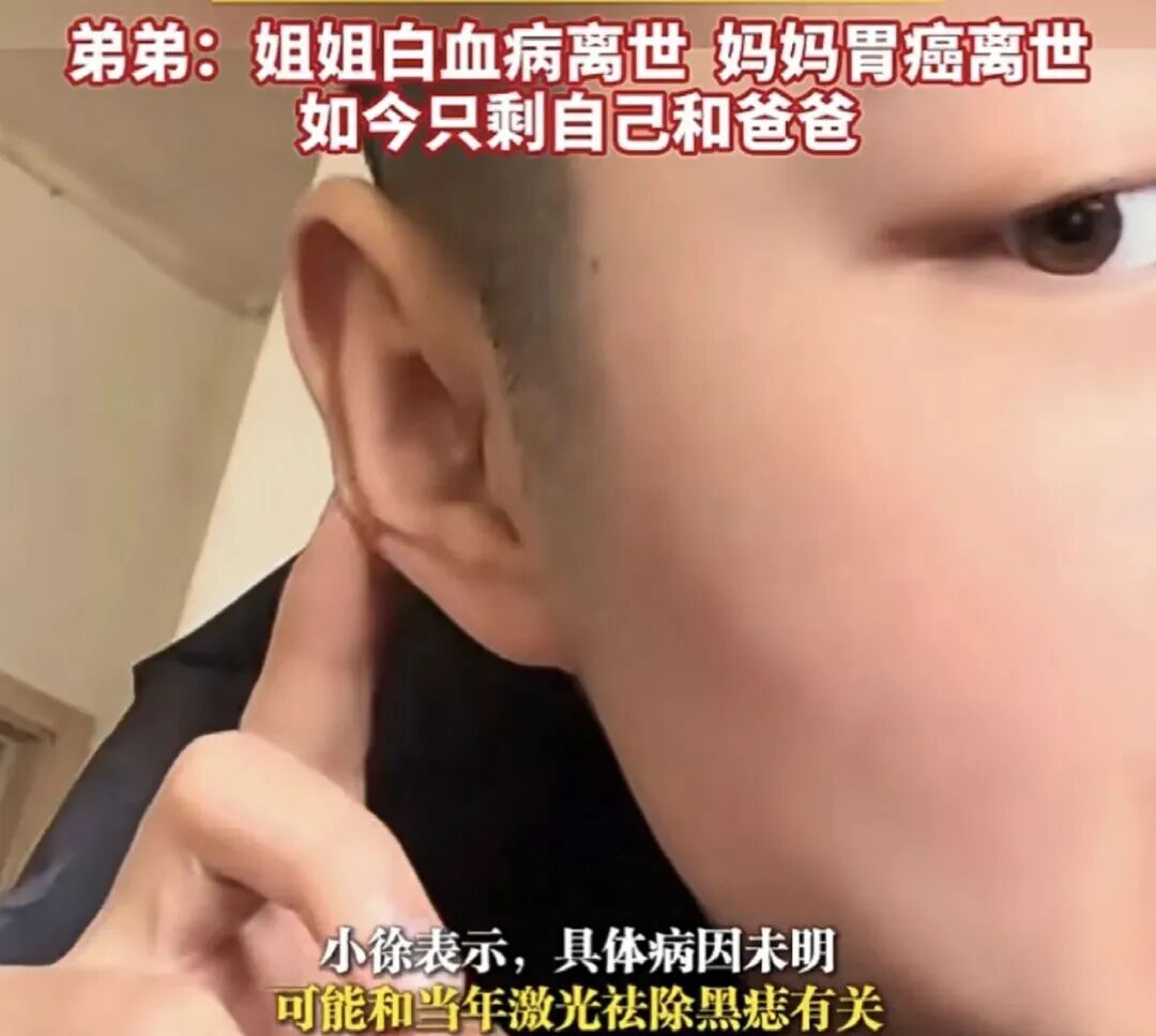 他不幸离世，年仅24岁！一生太坎坷！去年才确诊，脸上曾出现这些变化→