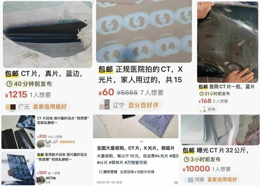 旧CT片成隐秘“银矿”？律师提醒：卖自己的片子也可能违法！
