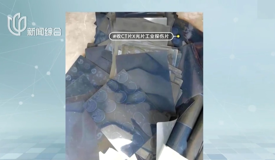 旧CT片突然值钱了！1.5元一张 二手平台上有人高价回收只为炼银