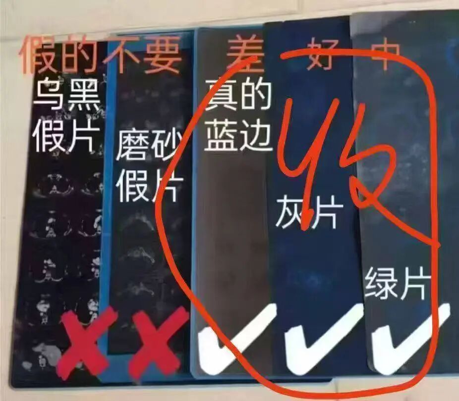 旧CT片成隐秘“银矿”？律师提醒：卖自己的片子也可能违法！