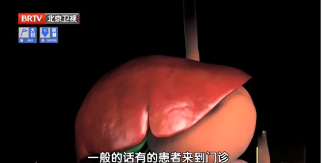 以为是过敏，结果是肝癌，这些伤肝的习惯，很多人天天都在做