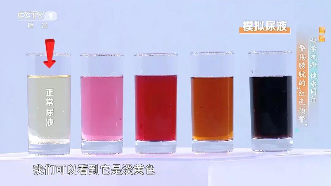 喝水后出现这种异常可能是癌症发出的信号 预防做好这5点→