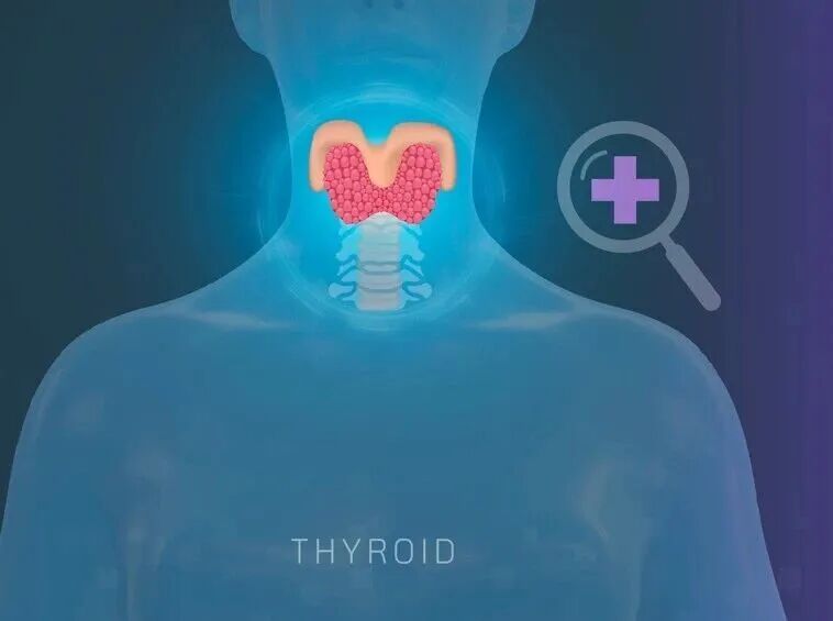 为什么越来越多年轻人查出甲状腺问题？真相竟是……