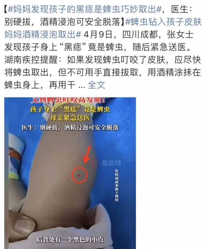 当心！身上忽然冒出这种小黑点，要尽快处理，严重可危及生命