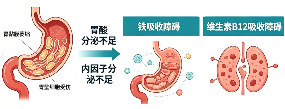 补血越补越虚？身体出现这3个异常，警惕胃癌来袭
