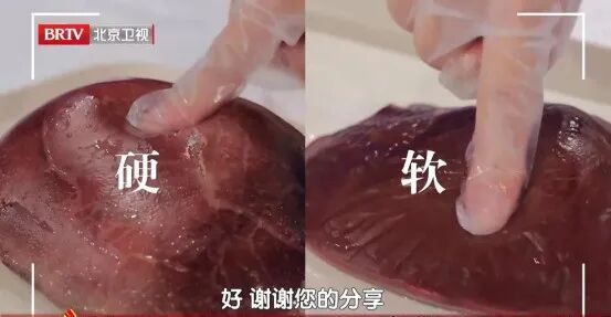 心梗距离猝死仅一步之遥，3招护心、护肝、降风险→