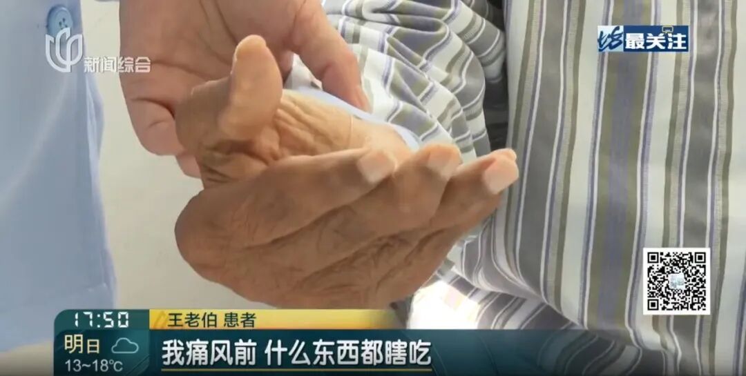 上海38岁男子手指黢黑可怖！有人硬抗30年变尿毒症…超1.8亿人中招