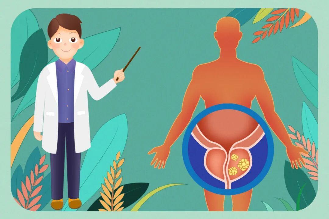 前列腺癌到底有多会“伪装”？