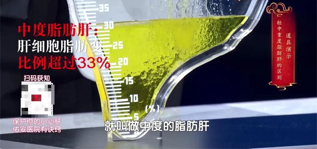 心梗距离猝死仅一步之遥，3招护心、护肝、降风险→