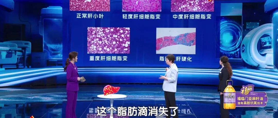 心梗距离猝死仅一步之遥，3招护心、护肝、降风险→